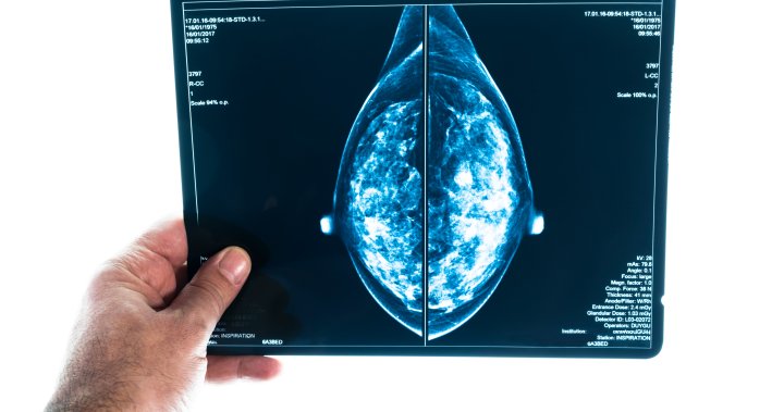 Canada won’t lower breast cancer screening guidelines to 40, despite expert pushback – National